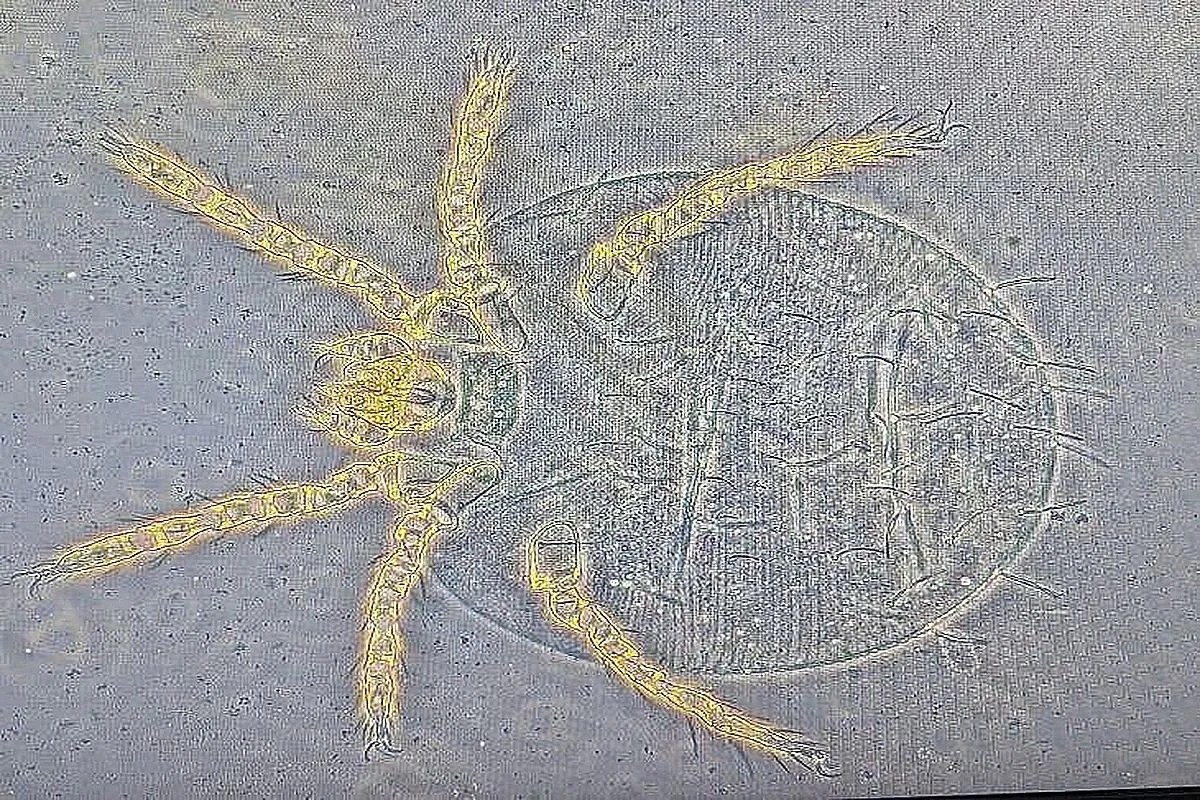 chigar mite