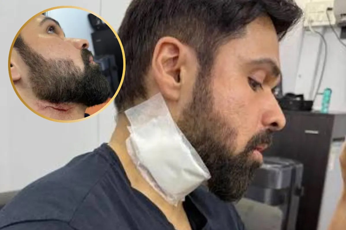 हादसे के बाद बाल-बाल बचे इमरान हाशमी का पहला पोस्ट आया सामने, फिल्म के नए गाने को लेकर दी जानकारी